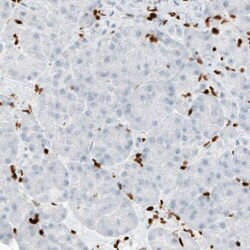 MEF2C Antibody (CL0369) - Azide and BSA Free, Novus Biologicals 100 ul;