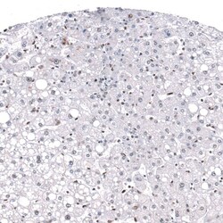 GLI-1 Antibody (CL12193) - Azide and BSA Free, Novus Biologicals 100 ul;