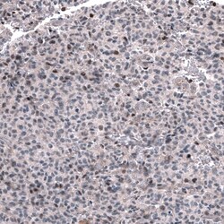 GLI-1 Antibody (CL12193) - Azide and BSA Free, Novus Biologicals 100 ul;