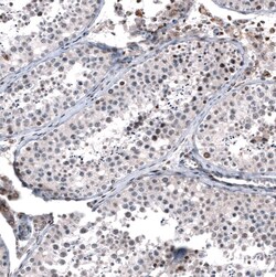 GLI-1 Antibody (CL12193) - Azide and BSA Free, Novus Biologicals 100 ul;