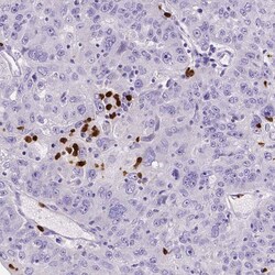 MMP-9 Antibody (CL0539) - Azide and BSA Free, Novus Biologicals 100 ul;
