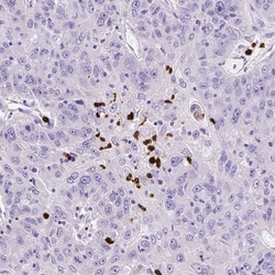 MMP-9 Antibody (CL0542) - Azide and BSA Free, Novus Biologicals 100 ul;