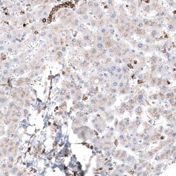 PBR Antibody (CL13359) - Azide and BSA Free, Novus Biologicals 100 ul;