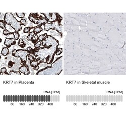Cytokeratin 7 Antibody (CL8725) - Azide and BSA Free, Novus Biologicals