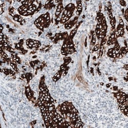 Cytokeratin 7 Antibody (CL8725) - Azide and BSA Free, Novus Biologicals