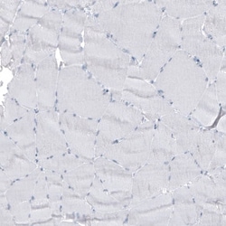 Cytokeratin 7 Antibody (CL8725) - Azide and BSA Free, Novus Biologicals