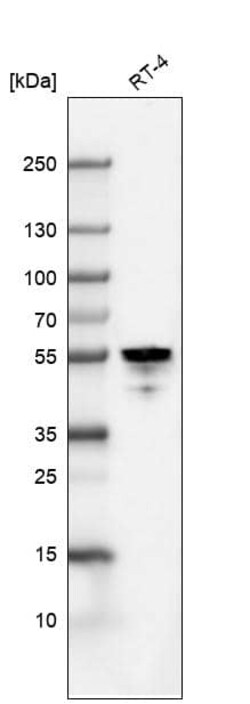 Cytokeratin 7 Antibody (CL8725) - Azide and BSA Free, Novus Biologicals