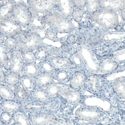 FATP5/SLC27A5 Antibody (CL0215) - Azide and BSA Free, Novus Biologicals