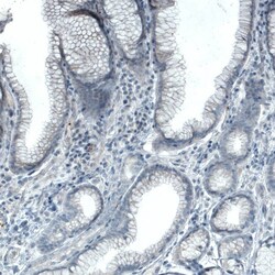 FATP5/SLC27A5 Antibody (CL0215) - Azide and BSA Free, Novus Biologicals