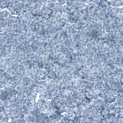 FATP5/SLC27A5 Antibody (CL0215) - Azide and BSA Free, Novus Biologicals