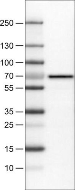FATP5/SLC27A5 Antibody (CL0216) - Azide and BSA Free, Novus Biologicals