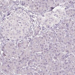 FATP5/SLC27A5 Antibody (CL0216) - Azide and BSA Free, Novus Biologicals