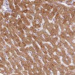 FATP5/SLC27A5 Antibody (CL0216) - Azide and BSA Free, Novus Biologicals
