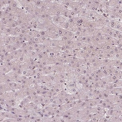 WHSC1 Antibody (CL1057) - Azide and BSA Free, Novus Biologicals 100 ul;