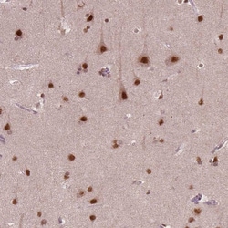 WHSC1 Antibody (CL1057) - Azide and BSA Free, Novus Biologicals 100 ul;
