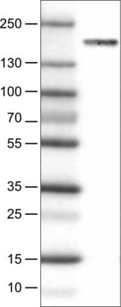 WHSC1 Antibody (CL1063) - Azide and BSA Free, Novus Biologicals 100 ul;
