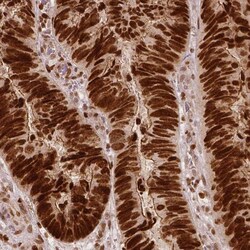 WHSC1 Antibody (CL1063) - Azide and BSA Free, Novus Biologicals 100 ul;