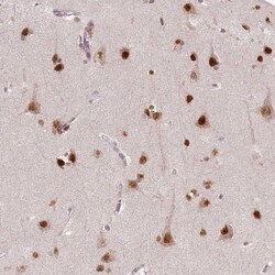 WHSC1 Antibody (CL1063) - Azide and BSA Free, Novus Biologicals 100 ul;