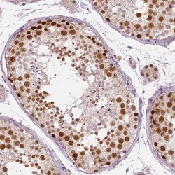 WHSC1 Antibody (CL1063) - Azide and BSA Free, Novus Biologicals 100 ul;