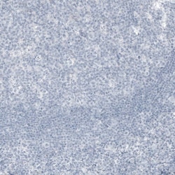 Kallikrein 3/PSA Antibody (CL9422) - Azide and BSA Free, Novus Biologicals