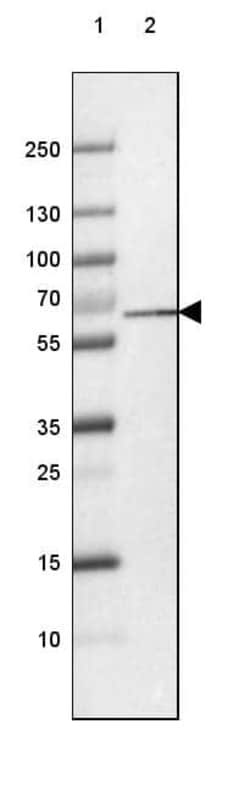 PGM1 Antibody (CL3299) - Azide and BSA Free, Novus Biologicals 100 ul;