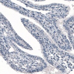 PGM1 Antibody (CL3299) - Azide and BSA Free, Novus Biologicals 100 ul;