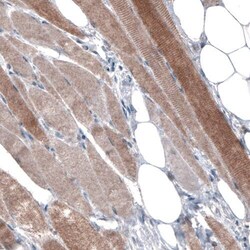 PGM1 Antibody (CL3299) - Azide and BSA Free, Novus Biologicals 100 ul;