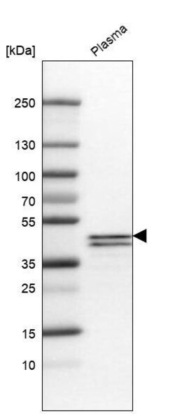 Apolipoprotein L1 Antibody (CL0173) - Azide and BSA Free, Novus Biologicals
