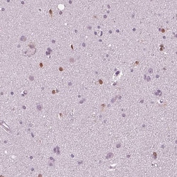 SOX9 Antibody (CL0639) - Azide and BSA Free, Novus Biologicals 100 ul;