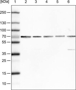 FUS Antibody (CL0190) - Azide and BSA Free, Novus Biologicals 100 ul; Unconjugated:Antikörper