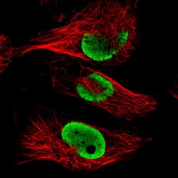 FUS Antibody (CL0190) - Azide and BSA Free, Novus Biologicals 100 ul; Unconjugated:Antikörper