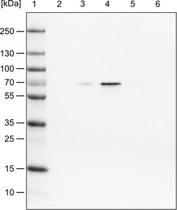 FUS Antibody (CL0190) - Azide and BSA Free, Novus Biologicals 100 ul; Unconjugated:Antikörper