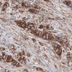 beta-Catenin Antibody (CL3689) - Azide and BSA Free, Novus Biologicals