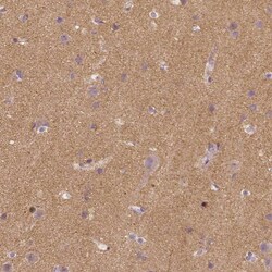 TSPAN7/TM4SF2 Antibody (CL0265) - Azide and BSA Free, Novus Biologicals