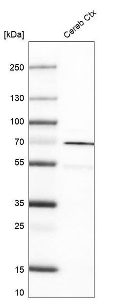 Rhot1 Antibody (CL1083) - Azide and BSA Free, Novus Biologicals 100 ul;