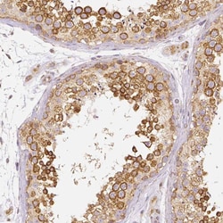 Rhot1 Antibody (CL1095) - Azide and BSA Free, Novus Biologicals 100 ul;
