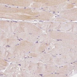 Rhot1 Antibody (CL1095) - Azide and BSA Free, Novus Biologicals 100 ul;