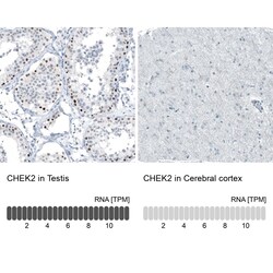 Chk2 Antibody (CL9440) - Azide and BSA Free, Novus Biologicals 100 ul;