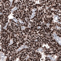 Chk2 Antibody (CL9440) - Azide and BSA Free, Novus Biologicals 100 ul;