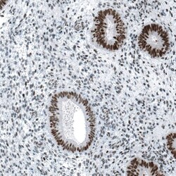 Chk2 Antibody (CL9440) - Azide and BSA Free, Novus Biologicals 100 ul;