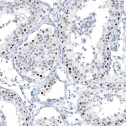 Chk2 Antibody (CL9440) - Azide and BSA Free, Novus Biologicals 100 ul;