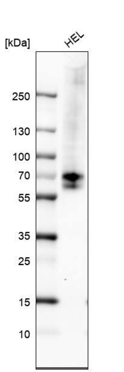 Chk2 Antibody (CL9440) - Azide and BSA Free, Novus Biologicals 100 ul;