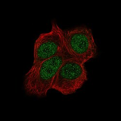 Chk2 Antibody (CL9440) - Azide and BSA Free, Novus Biologicals 100 ul;