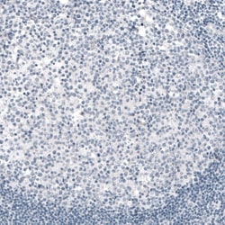 TYRP1 Antibody (CL4923) - Azide and BSA Free, Novus Biologicals 100 ul;