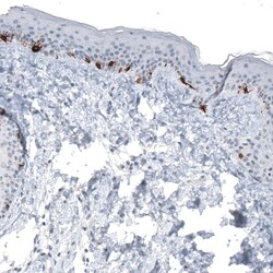 TYRP1 Antibody (CL4923) - Azide and BSA Free, Novus Biologicals 100 ul;