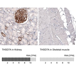 THSD7A Antibody (CL3778) - Azide and BSA Free, Novus Biologicals 100 ul;