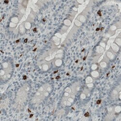 CD117/c-kit Antibody (CL1667) - Azide and BSA Free, Novus Biologicals 100