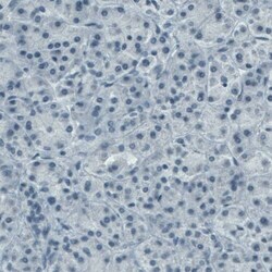 CD117/c-kit Antibody (CL1657) - Azide and BSA Free, Novus Biologicals 100