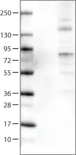 ACSL5 Antibody (CL0275) - Azide and BSA Free, Novus Biologicals 100 ul;
