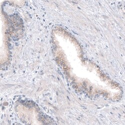 CDKL5 Antibody (CL4881) - Azide and BSA Free, Novus Biologicals 100 ul;